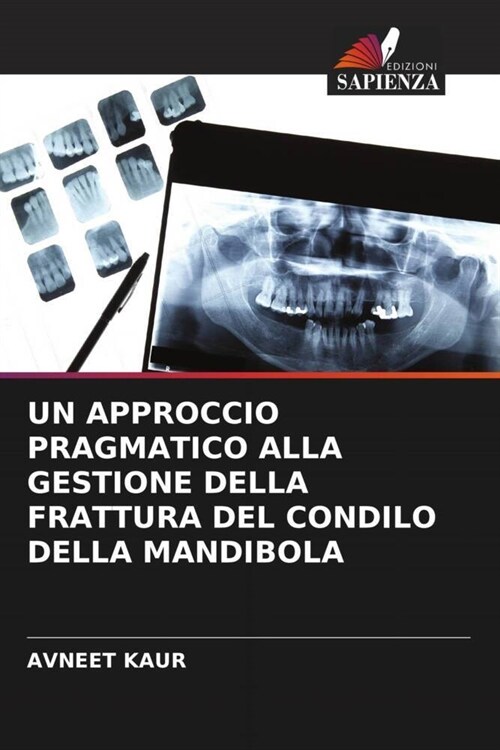 UN APPROCCIO PRAGMATICO ALLA GESTIONE DELLA FRATTURA DEL CONDILO DELLA MANDIBOLA (Paperback)