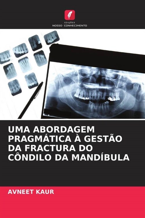 UMA ABORDAGEM PRAGMATICA A GESTAO DA FRACTURA DO CONDILO DA MANDIBULA (Paperback)