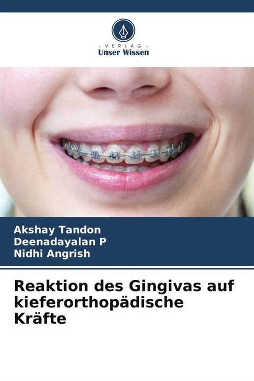 Reaktion des Gingivas auf kieferorthopadische Krafte (Paperback)