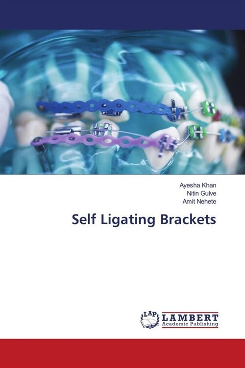 Self Ligating Brackets (Paperback)