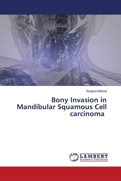 Bony Invasion in Mandibular Squamous Cell carcinoma (Paperback)