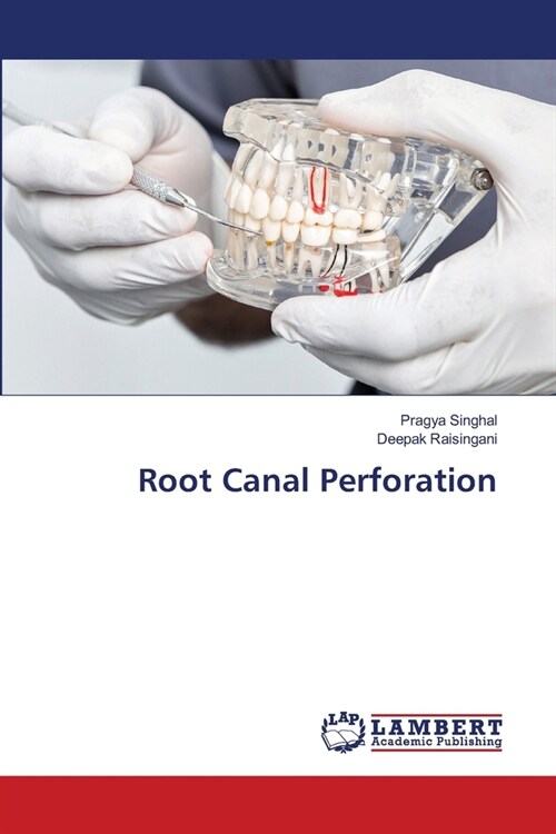 Root Canal Perforation (Paperback)