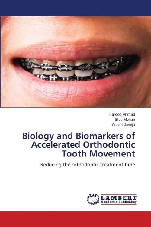 Biology and Biomarkers of Accelerated Orthodontic Tooth Movement (Paperback)