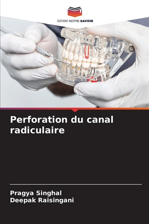 Perforation du canal radiculaire (Paperback)