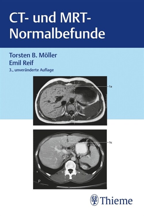 CT und MRT Normalbefunde (Paperback)