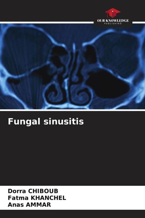 Fungal sinusitis (Paperback)