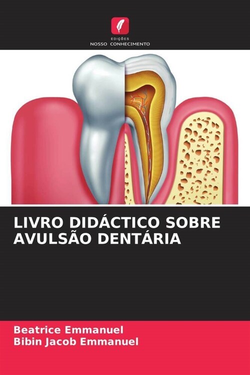 LIVRO DIDACTICO SOBRE AVULSAO DENTARIA (Paperback)