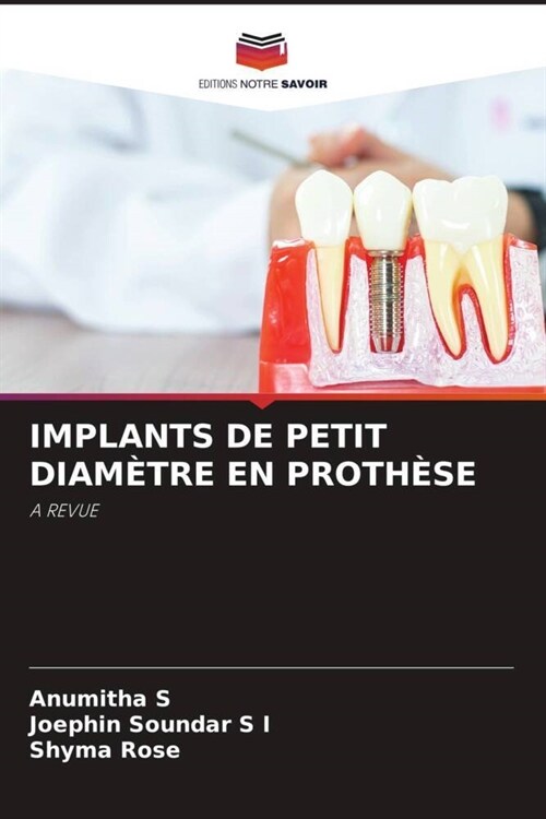 IMPLANTS DE PETIT DIAMETRE EN PROTHESE (Paperback)