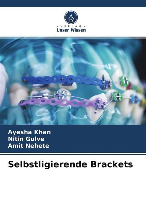 Selbstligierende Brackets (Paperback)