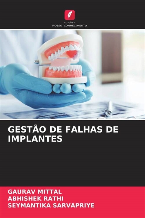 GESTAO DE FALHAS DE IMPLANTES (Paperback)