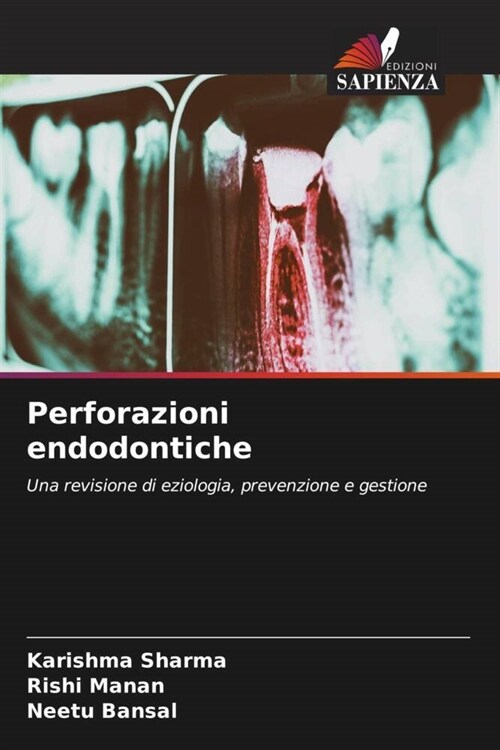 Perforazioni endodontiche (Paperback)