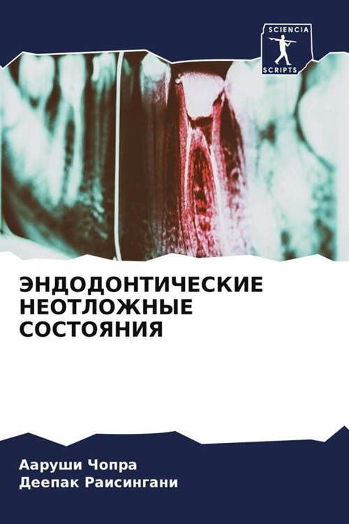 JeNDODONTIChESKIE NEOTLOZhNYE SOSTOYaNIYa (Paperback)