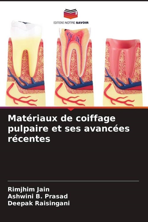 Materiaux de coiffage pulpaire et ses avancees recentes (Paperback)