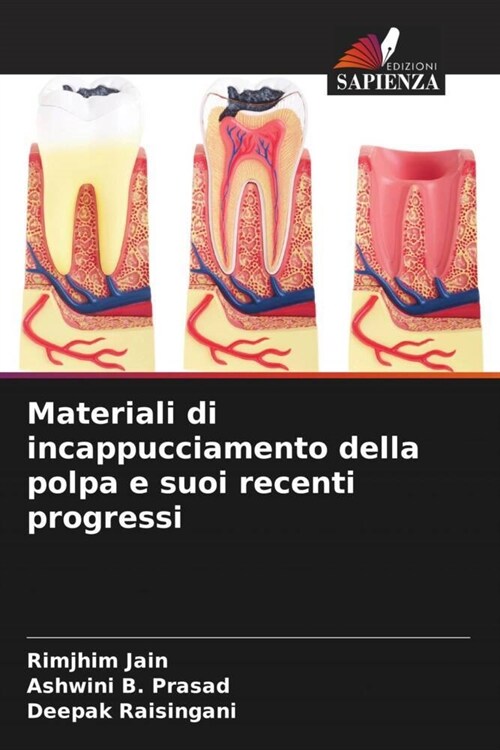 Materiali di incappucciamento della polpa e suoi recenti progressi (Paperback)