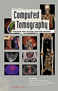 Computed Tomography: Fundamentals, System Technology, Image Quality, Applications (Hardcover, 3, Revised)