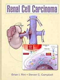 Renal Cell Carcinoma (Hardcover)