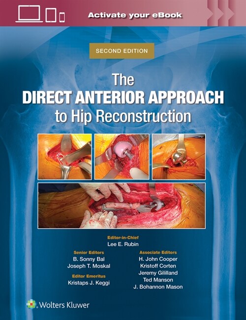 The Direct Anterior Approach to Hip Reconstruction (Hardcover, 2)