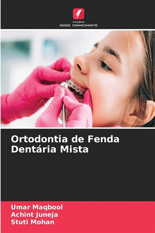 Ortodontia de Fenda Dent?ia Mista (Paperback)