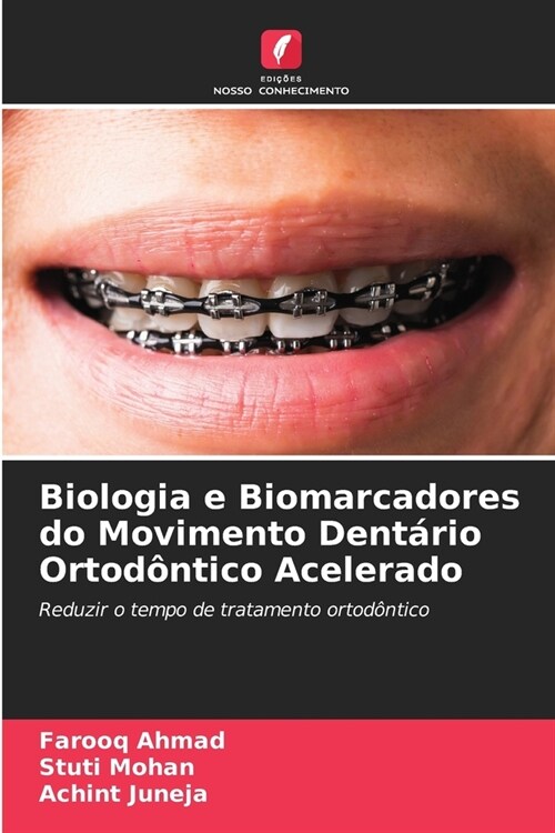 Biologia e Biomarcadores do Movimento Dent?io Ortod?tico Acelerado (Paperback)