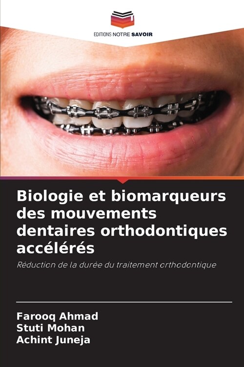 Biologie et biomarqueurs des mouvements dentaires orthodontiques acc??? (Paperback)