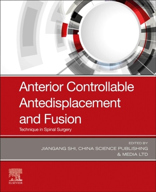 Anterior Controllable Antedisplacement and Fusion: Technique in Spinal Surgery (Paperback)