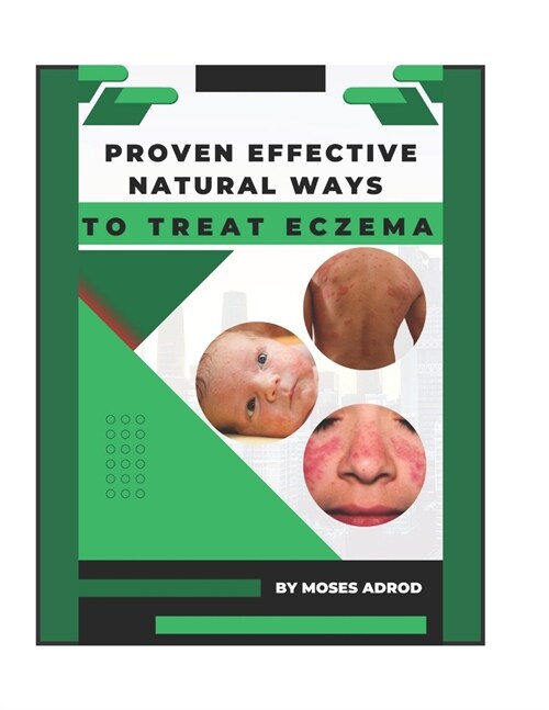 Proven Effective Natural Ways to Treat Eczema (Paperback)