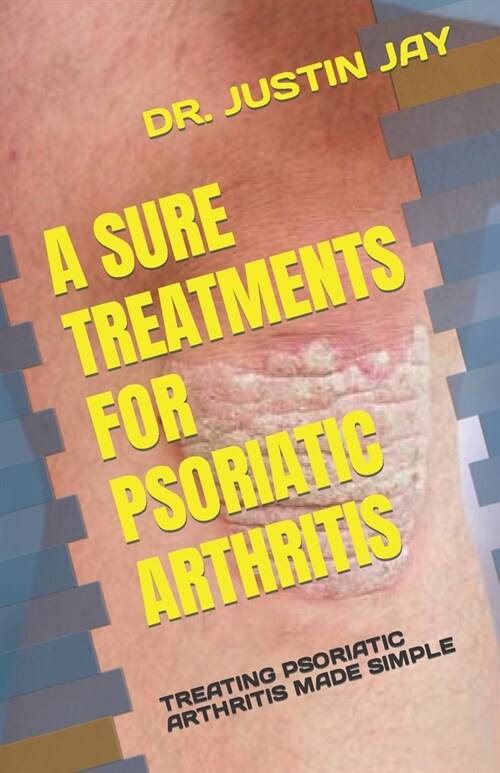 A Sure Treatments for Psoriatic Arthritis: Treating Psoriatic Arthritis Made Simple (Paperback)