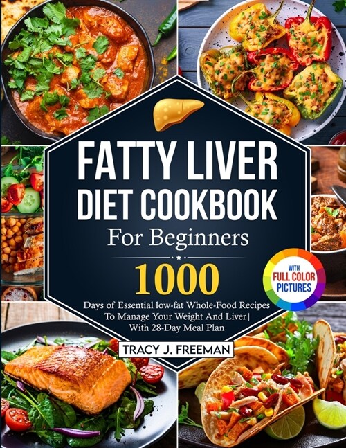 Fatty Liver Diet Cookbook For Beginners: 1000 days of Essential low-fat Whole-Food Recipes To Manage Your Weight And Liver With 28-Day Meal Plan With (Paperback)
