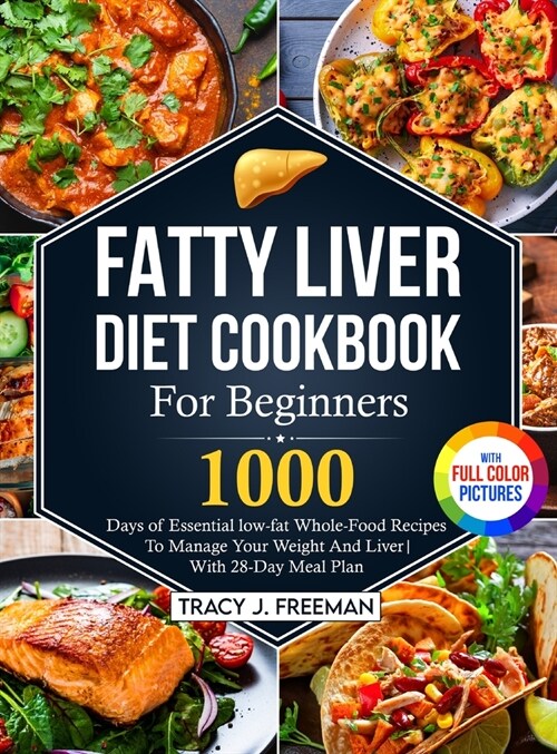 Fatty Liver Diet Cookbook For Beginners: 1000 days of Essential low-fat Whole-Food Recipes To Manage Your Weight And Liver With 28-Day Meal Plan With (Hardcover)