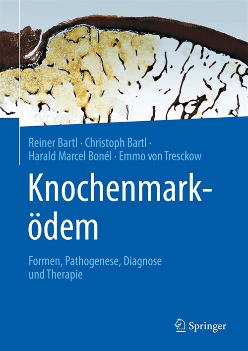 Knochenmark?em: Formen, Pathogenese, Diagnose Und Therapie (Hardcover, 1. Aufl. 2023)