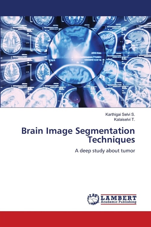 Brain Image Segmentation Techniques (Paperback)