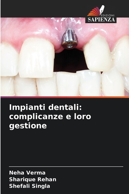 Impianti dentali: complicanze e loro gestione (Paperback)