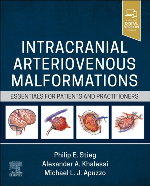 Intracranial Arteriovenous Malformations: Essentials for Patients and Practitioners (Hardcover)