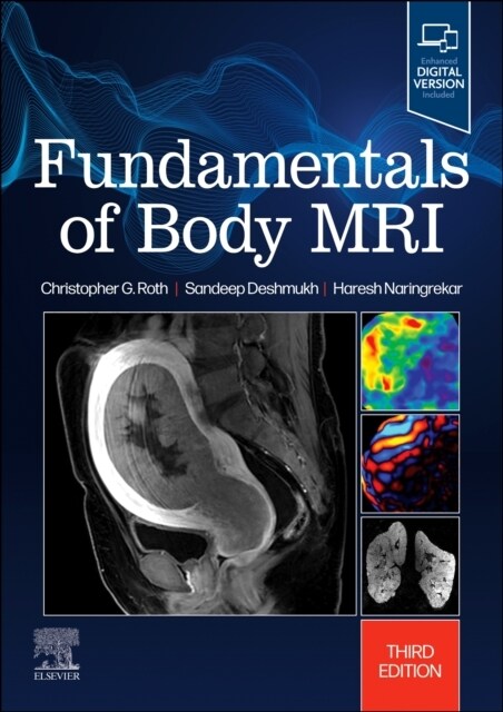 Fundamentals of Body MRI (Paperback, 3)