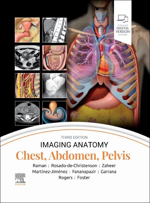 Imaging Anatomy: Chest, Abdomen, Pelvis (Hardcover, 3)
