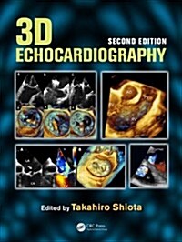 3D Echocardiography (Package, 2 New edition)