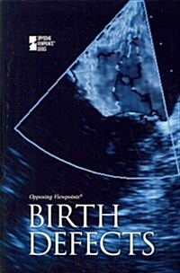 Birth Defects (Paperback)