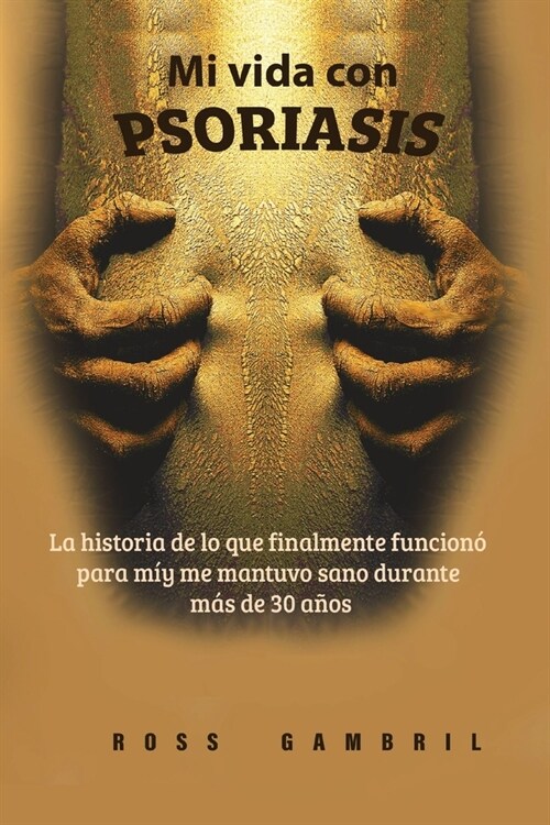 Mi vida con PSORIASIS (Paperback)