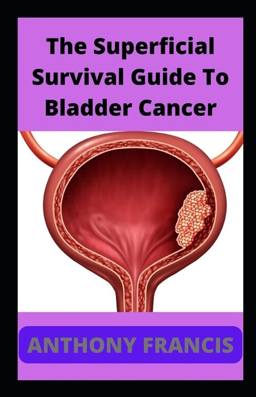 The Superficial Survival Guide To Bladder Cancer: Surviving Bladder Cancer (Paperback)