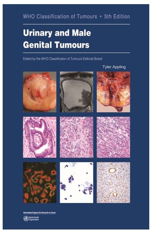 Urinary and Male Genital Tumours (Paperback)