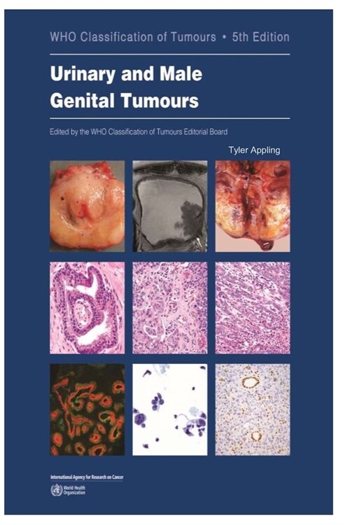 Urinary and Male Genital Tumours (Paperback)