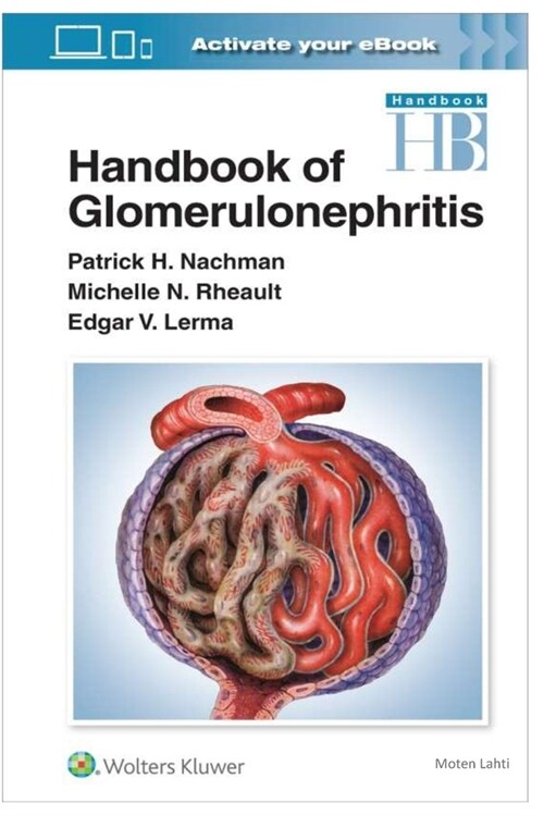 Handbook of Glomerulonephritis (Paperback)