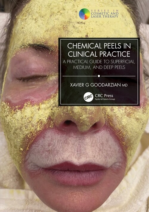 Chemical Peels in Clinical Practice : A Practical Guide to Superficial, Medium, and Deep Peels (Paperback)