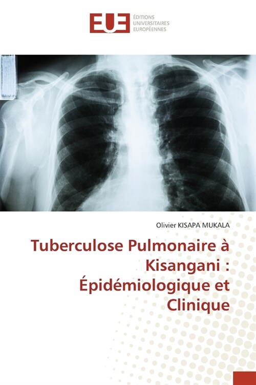 Tuberculose Pulmonaire ?Kisangani: ?id?iologique et Clinique (Paperback)