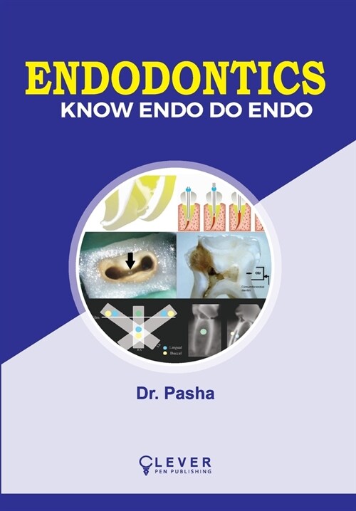 Endodontics (Paperback)