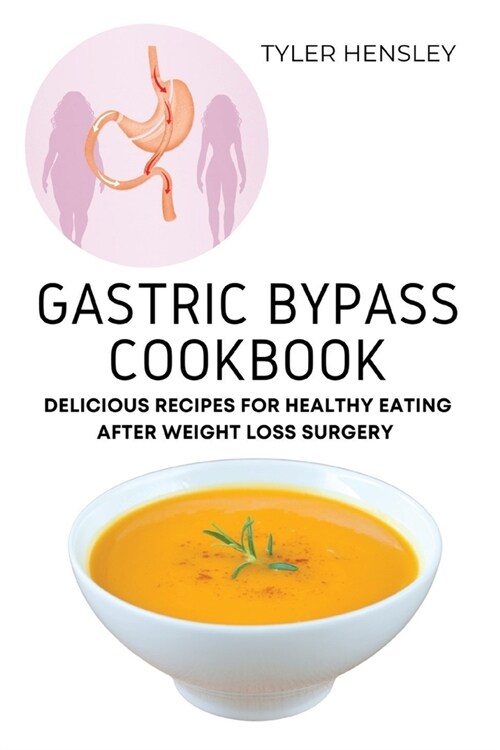 Gastric Bypass Cookbook: Delicious Recipes for Healthy Eating After Weight Loss Surgery (Paperback)