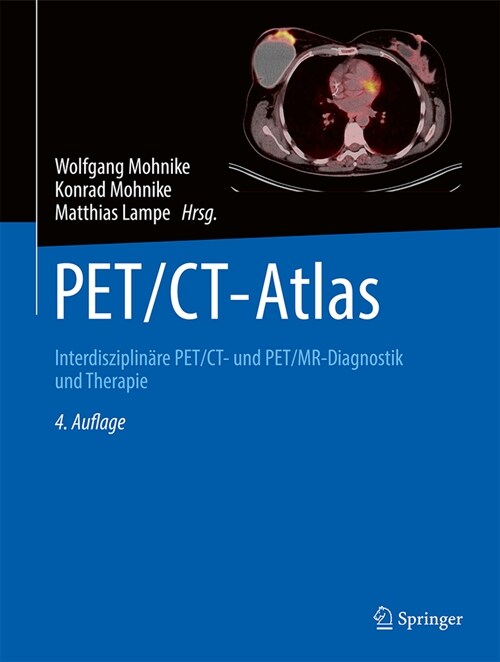 Pet/Ct-Atlas: Interdisziplin?e Pet/Ct- Und Pet/Mr-Diagnostik Und Therapie (Hardcover, 4, 4., Erw. U. Vol)
