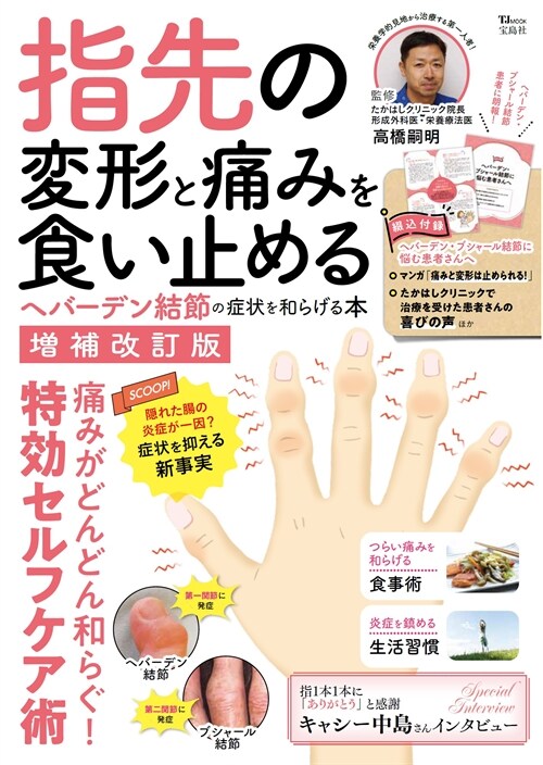 指先の變形と痛みを食い止めるヘバ-デン結節の症狀を和らげる本 增補改訂版 (TJ MOOK)