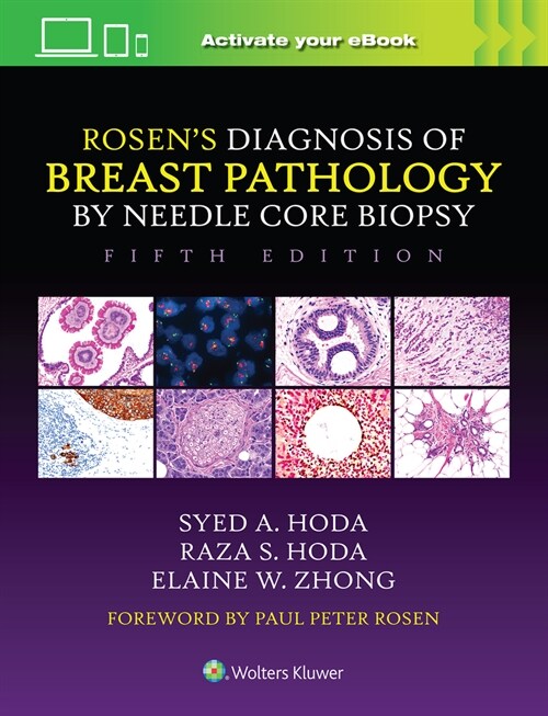 Rosens Diagnosis of Breast Pathology by Needle Core Biopsy (Hardcover, 5)