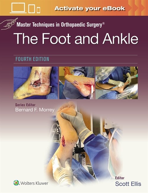 Master Techniques in Orthopaedic Surgery: The Foot and Ankle: Print + eBook with Multimedia (Hardcover, 4)